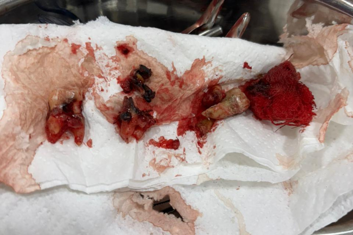 After Treatment